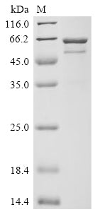 Greater than 85% as determined by SDS-PAGE.Recombinant Streptococcus Pyogenes Serotype M1 C5A Peptidase (SCPA) Protein (His)