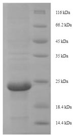 Greater than 90% as determined by SDS-PAGE.