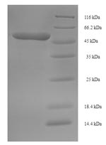 Greater than 90% as determined by SDS-PAGE.Recombinant Zaire Ebolavirus Pre-Small/Secreted Glycoprotein (GP) Protein (His-SUMO)