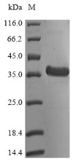 Greater than 85% as determined by SDS-PAGE.Recombinant Mycobacterium Tuberculosis Probable Cutinase Rv1984C (RV1984C) Protein (His-SUMO&Myc)