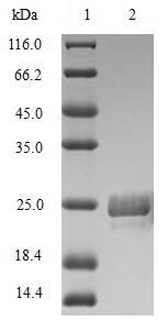 Greater than 90% as determined by SDS-PAGE.Recombinant Heteroscodra Maculata Delta-Theraphotoxin-Hm1A (DELTA-TRTX-HM1A) Protein (His-SUMO&Myc)