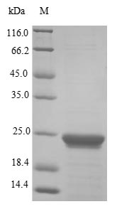 Greater than 85% as determined by SDS-PAGE.Recombinant Human Peptidyl-Prolyl Cis-Trans Isomerase A (PPIA) Protein (His&Myc)