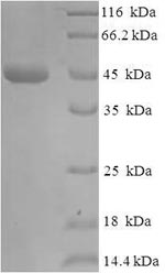 Greater than 90% as determined by SDS-PAGE.Recombinant E.Coli Beta-Lactamase Tem (BLA;) Protein (His-SUMO)