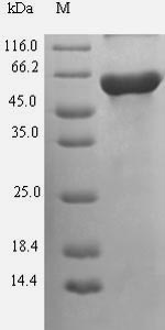 Greater than 90% as determined by SDS-PAGE.Recombinant Human Guanine nucleotide-binding protein G (GNAS) Protein (His-SUMO)