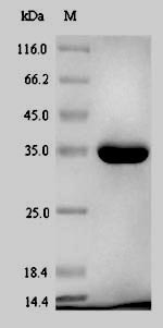 Greater than 90% as determined by SDS-PAGE.Recombinant E.Coli Phosphoheptose Isomerase (GMHA) Protein (His-SUMO)