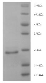 Greater than 90% as determined by SDS-PAGE.Recombinant Naja Atra Cytotoxin 4 (CTX-4M) Protein (His-SUMO)