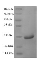 Greater than 90% as determined by SDS-PAGE.Recombinant Centruroides Noxius Beta-Mammal Toxin Cn2 (TOXIN 2) Protein (His-SUMO)