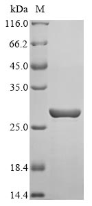 Greater than 85% as determined by SDS-PAGE.Recombinant Lens Culinaris Lectin Protein (His&Myc)