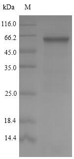 Greater than 90% as determined by SDS-PAGE.Recombinant Streptococcus Pyogenes Serotype M5 M Protein, Serotype 5 (EMM5) Protein (His&Myc)