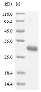 Greater than 85% as determined by SDS-PAGE.Recombinant Jc Polyomavirus Small T Antigen (ST) Protein (His&Myc)