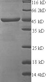 Greater than 90% as determined by SDS-PAGE.Recombinant Jc Polyomavirus Minor Capsid Protein Vp2 Protein (His-SUMO)