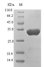 Greater than 90% as determined by SDS-PAGE.Recombinant Hepatitis B Virus Genotype D Subtype Ayw Protein X (X) Protein (His-SUMO)