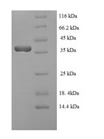 Greater than 90% as determined by SDS-PAGE.Recombinant Epstein-Barr Virus Lytic Switch Protein Bzlf1 (BZLF1) Protein (His-SUMO)