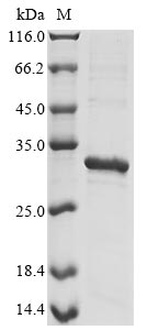 Greater than 85% as determined by SDS-PAGE.