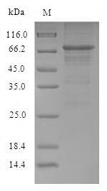 Greater than 90% as determined by SDS-PAGE.Recombinant Influenza A Virus Nucleoprotein (NP) Protein (His-B2M)