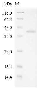 Greater than 85% as determined by SDS-PAGE.Recombinant Human Adenovirus C Serotype 5 Hexon Protein (L3) Protein (His&Myc)