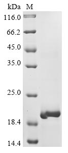 Greater than 90% as determined by SDS-PAGE.Recombinant Influenza A Virus Matrix Protein 1 (M1) Protein (His)