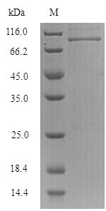 Greater than 90% as determined by SDS-PAGE.Recombinant Influenza B Virus Nucleoprotein (NP) Protein (His-SUMO)