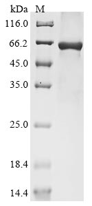 Greater than 85% as determined by SDS-PAGE.Recombinant Influenza A Virus Hemagglutinin (HA) Protein (His)
