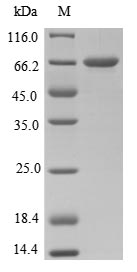 Greater than 85% as determined by SDS-PAGE.Recombinant Clostridium Tetani Tetanus Toxin (TETX) Protein (His-B2M)