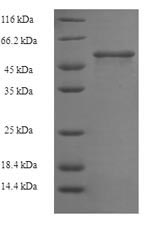 Greater than 90% as determined by SDS-PAGE.Recombinant Clostridium Tetani Tetanus Toxin (TETX) Protein (His)