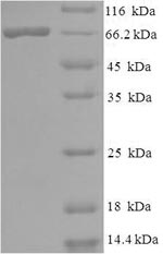 Greater than 90% as determined by SDS-PAGE.Recombinant Human Papillomavirus Type 18 Minor Capsid Protein L2 (L2) Protein (His-SUMO)