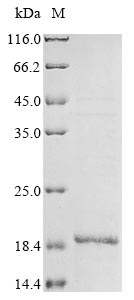Greater than 85% as determined by SDS-PAGE.Recombinant Influenza A Virus Matrix Protein 2 (M) Protein (His&Myc)