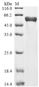 Greater than 85% as determined by SDS-PAGE.Recombinant Serratia Marcescens Serralysin Protein (His)