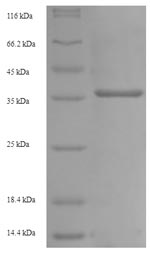 Greater than 90% as determined by SDS-PAGE.Recombinant Mouse Low Affinity Immunoglobulin Gamma Fc Region Receptor Iii (FCGR3) Protein (His-SUMO)