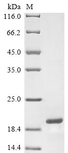 Greater than 85% as determined by SDS-PAGE.Recombinant Mouse Lysozyme C-2 (LYZ2) Protein (His&Myc)