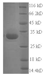 Greater than 90% as determined by SDS-PAGE.Recombinant Staphylococcus Aureus Exfoliative Toxin A (ETA) Protein (His)