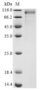 Greater than 90% as determined by SDS-PAGE.Recombinant Mouse Kidney Parvovirus Nonstructural Protein Ns1 (REP) Protein (His&Myc)