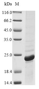 Greater than 85% as determined by SDS-PAGE.Recombinant Rickettsia Rickettsii 17 Kda Surface Antigen (OMP) Protein (His&Myc)