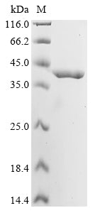 Greater than 90% as determined by SDS-PAGE.Recombinant Mycobacterium Bovis O-Acetylserine Sulfhydrylase (CYSK) Protein (His&Myc)