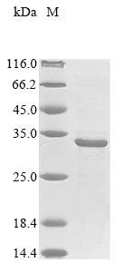 Greater than 85% as determined by SDS-PAGE.Recombinant Mycobacterium Tuberculosis Heparin-Binding Hemagglutinin (HBHA) Protein (His&Myc)