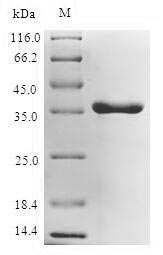 Greater than 90% as determined by SDS-PAGE.Recombinant E.Coli Udp-3-O-Acyl-N-Acetylglucosamine Deacetylase (LPXC) Protein (His)