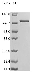 Greater than 85% as determined by SDS-PAGE.Recombinant E.Coli Polyphosphate Kinase (PPK) Protein (His)