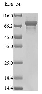 Greater than 85% as determined by SDS-PAGE.Recombinant E.Coli Polyphosphate Kinase (PPK) Protein (His&Myc)