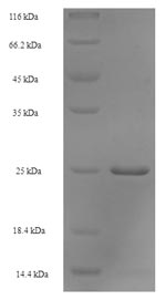 Greater than 90% as determined by SDS-PAGE.Recombinant E.Coli Peptidyl-Trna Hydrolase (PTH) Protein (His)