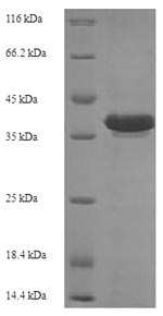 Greater than 90% as determined by SDS-PAGE.Recombinant E.Coli Recombination Protein Recr (RECR) Protein (His-SUMO)