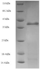 Greater than 90% as determined by SDS-PAGE.Recombinant E.Coli Holliday Junction Atp-Dependent Dna Helicase Ruva (RUVA) Protein (His-SUMO)