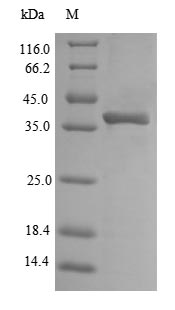 Greater than 90% as determined by SDS-PAGE.Recombinant E.Coli O157:H7 Outer Membrane Protein A (OMPA) Protein (His-SUMO)