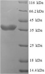 Greater than 90% as determined by SDS-PAGE.Recombinant E.Coli O6:H1 Lipopolysaccharide Export System Protein Lptc (LPTC) Protein (His-SUMO)