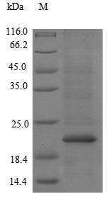 Greater than 90% as determined by SDS-PAGE.Recombinant E.Coli Trna Threonylcarbamoyladenosine Biosynthesis Protein Tsae (TSAE) Protein (His)