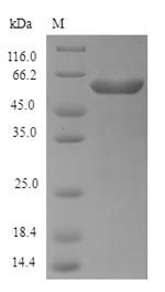 Greater than 90% as determined by SDS-PAGE.Recombinant E.Coli O6:H1 Exopolyphosphatase (PPX) Protein (His)
