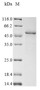 Greater than 85% as determined by SDS-PAGE.Recombinant Human Urokinase-Type Plasminogen Activator (PLAU) Protein (His)