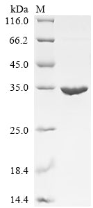 Greater than 90% as determined by SDS-PAGE.Recombinant Staphylococcus Aureus Enterotoxin Type B (ENTB) Protein (His)