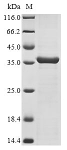 Greater than 85% as determined by SDS-PAGE.Recombinant Klebsiella Pneumoniae Ompk36 (OMPK36)