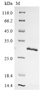 Greater than 85% as determined by SDS-PAGE.Recombinant Hepatitis B Virus Genotype A2 Subtype Adw2 Capsid Protein (C) Protein (His)