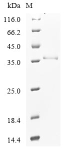 Greater than 90% as determined by SDS-PAGE.Recombinant Hepatitis B Virus Genotype A2 Subtype Adw2 Capsid Protein (C) Protein (His-SUMO)